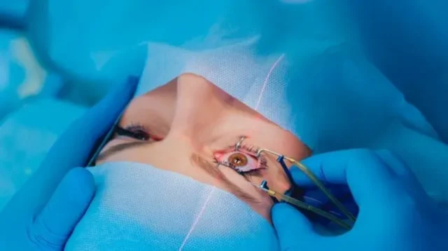 Lasik Aman Solusi Modern untuk Penglihatan Lebih Baik